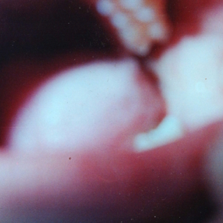 kqvc - replace-retract